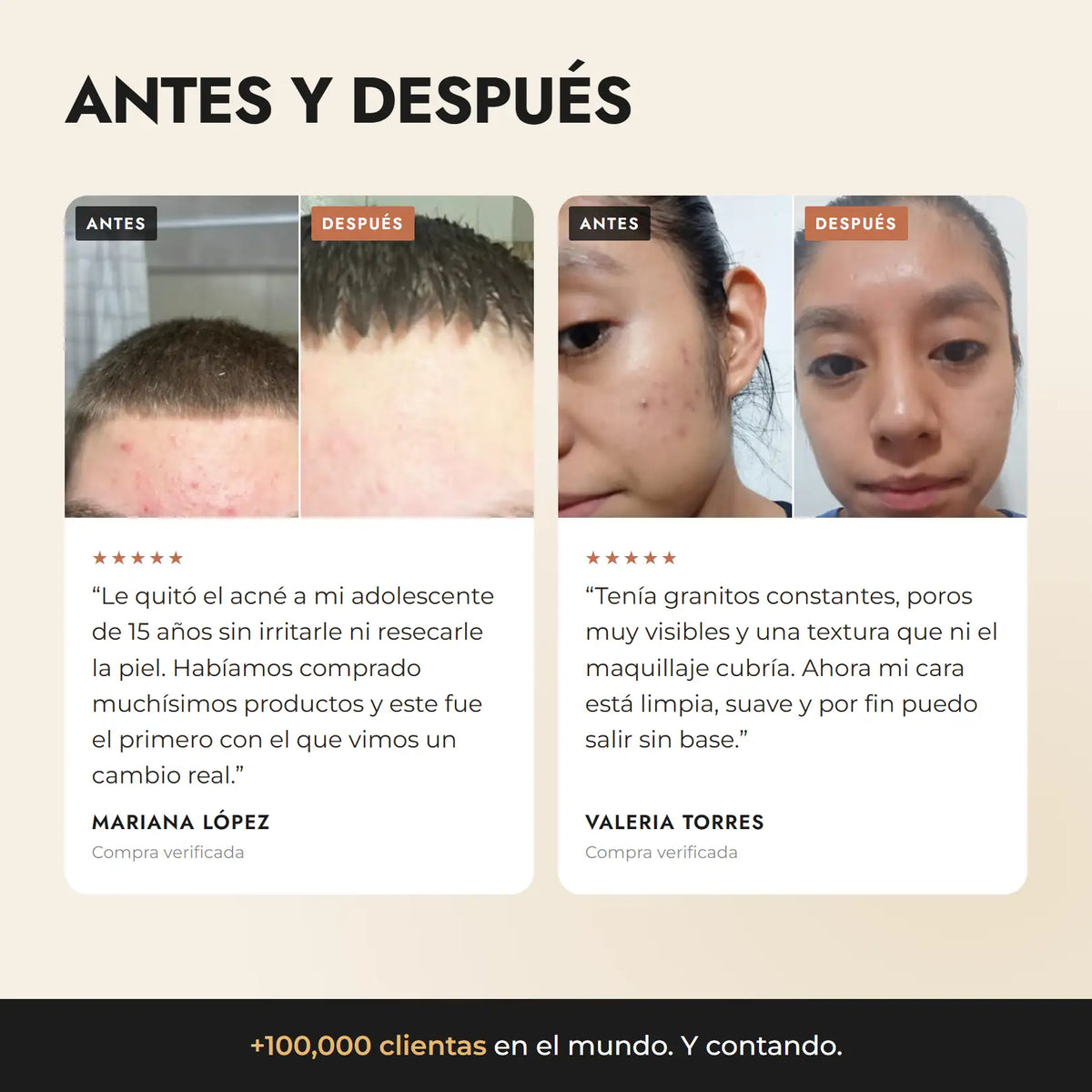 Antes y después de dos clientas de Pin-Up Secret con sus reseñas verificadas