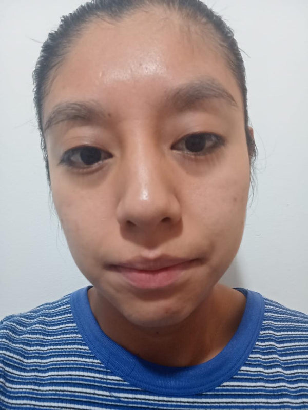 Después